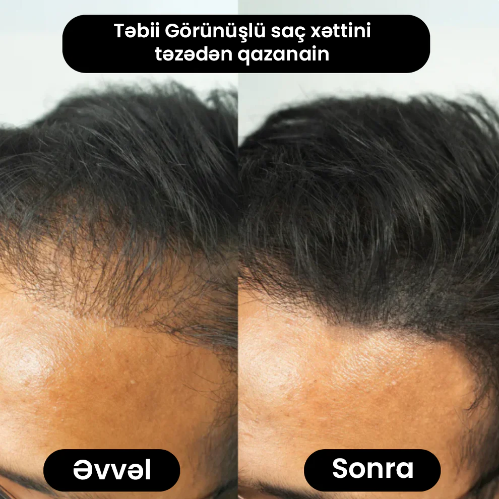 Saç Pudrası