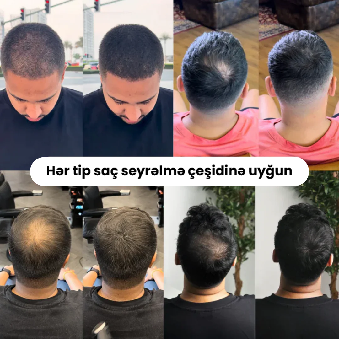 Saç Pudrası