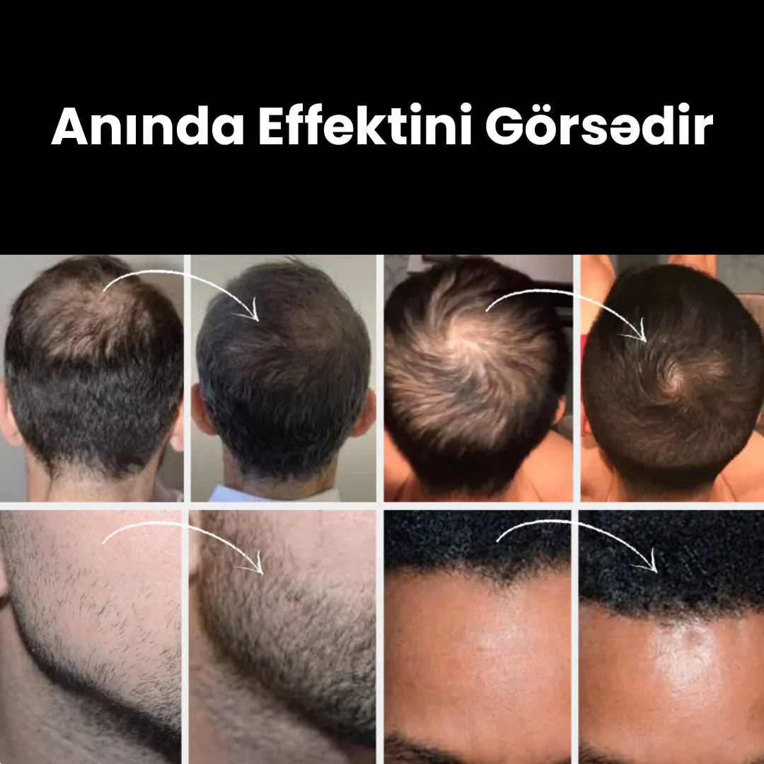 Saç Pudrası