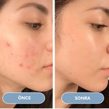 Filterli Duş Başlıqı